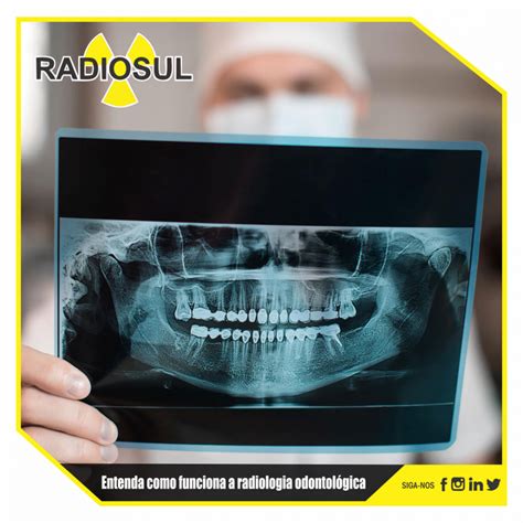 x face radiologia odontológica